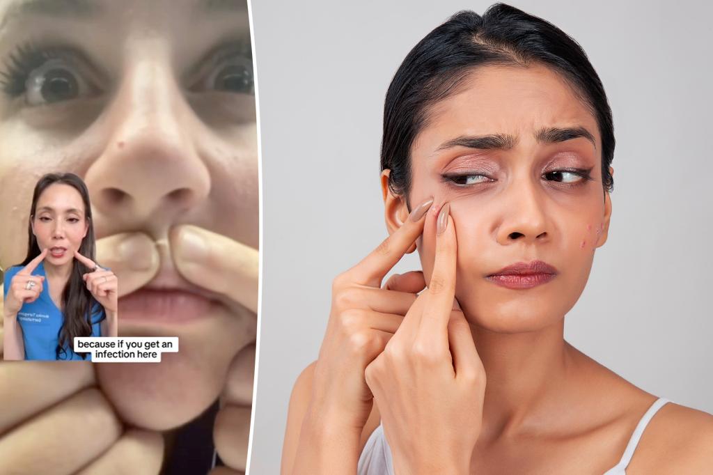 The best way to pop a pimple, according to a top dermatologist